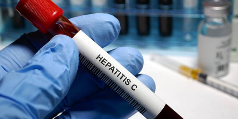 New Treatments for Hepatitis C: A Look at Affordability